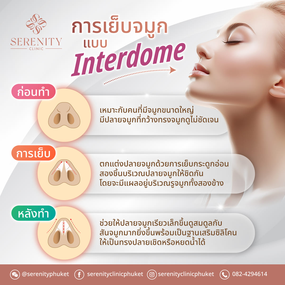 ขั้นตอนการเย็บปลายจมูกแบบ Interdome ก่อนทำ ระหว่างเย็บ และหลังทำ