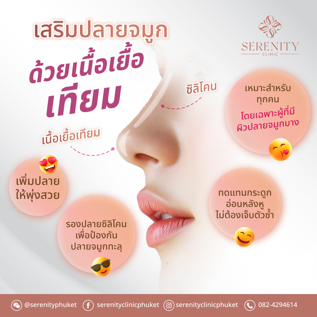 การเสริมปลายจมูกด้วยเนื้อเยื่อเทียมเพื่อรองปลายซิลิโคน
